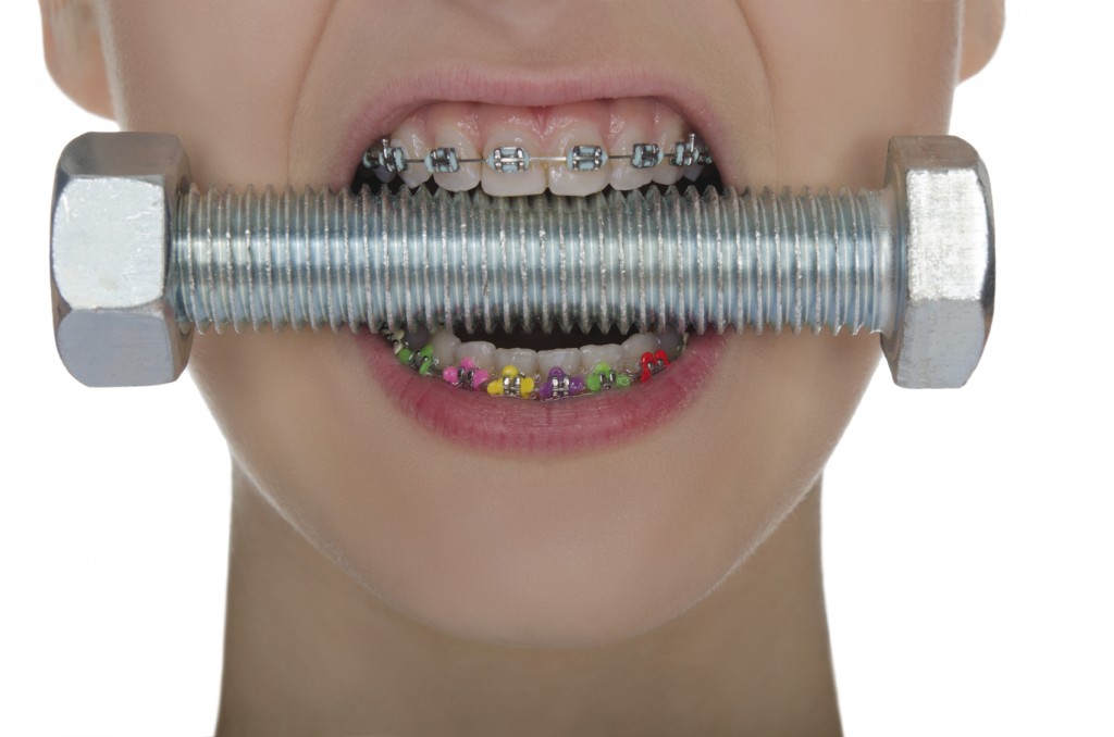 Ask Your New Caney Dentist: Should I Get Metal or Clear Braces?