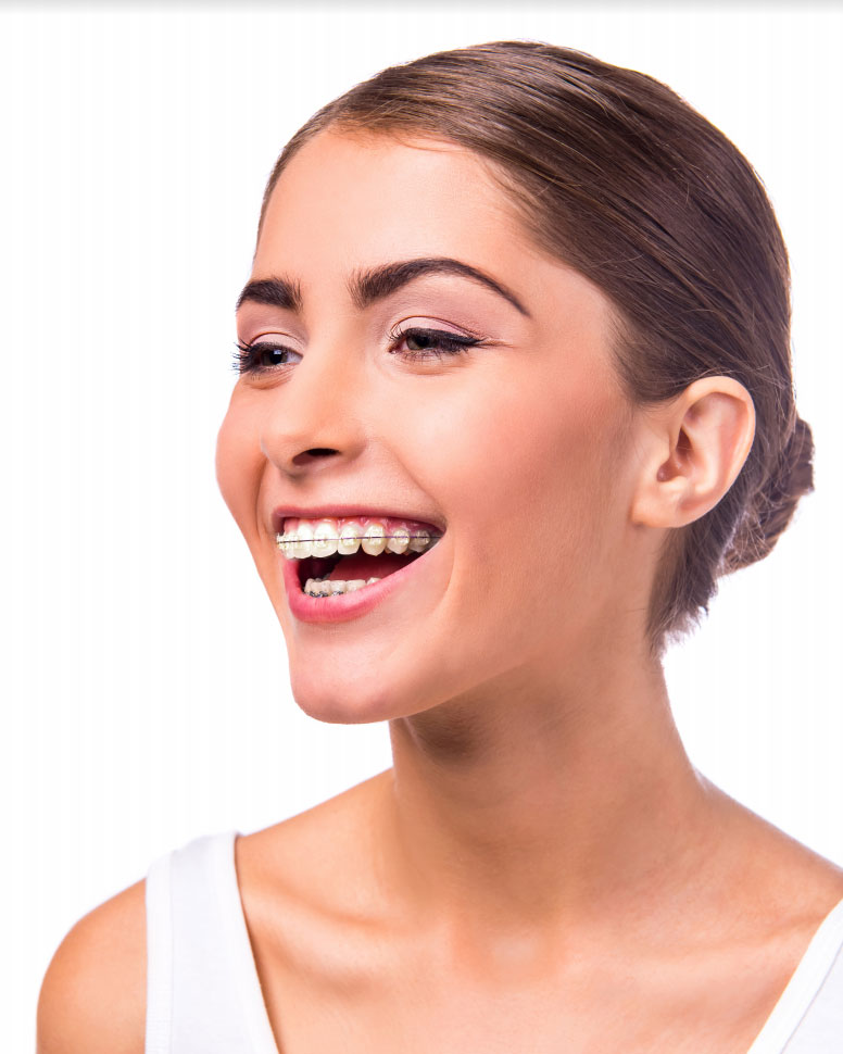 How Ceramic Braces Can Help Your Smile